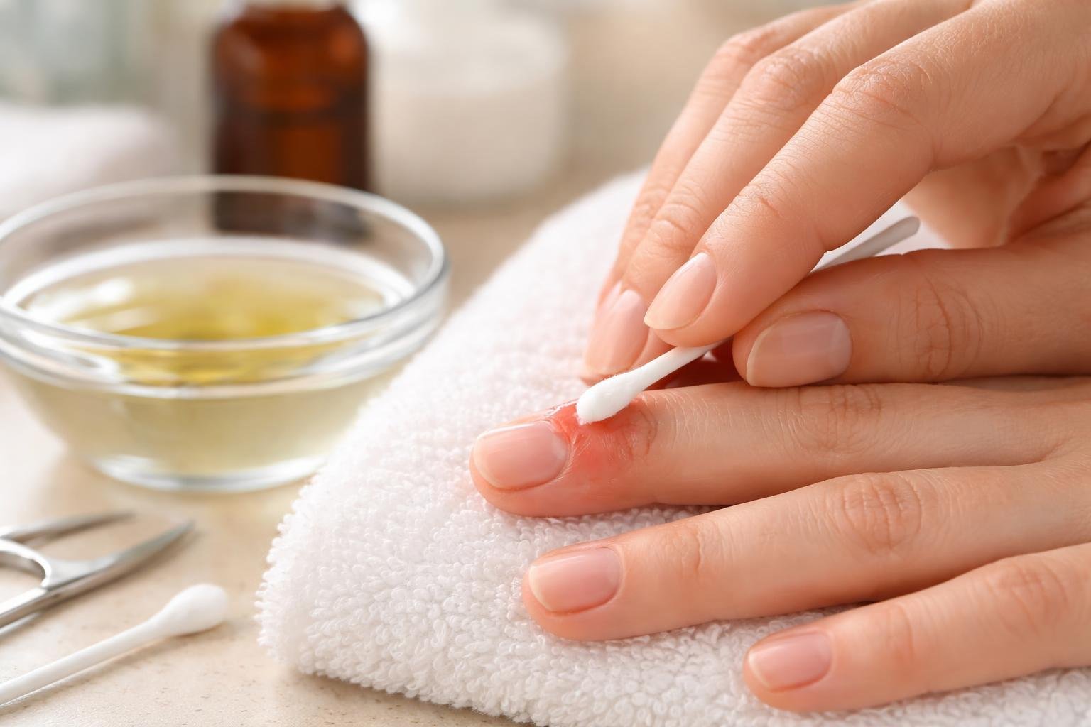 Mão recebendo cuidado delicado para paroníquia, com algodão e água morna em ambiente limpo.